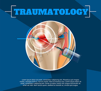 3dVectorBanner图像解剖人体膝盖联合治疗Osteoarthritis注射药物方法健康膝盖联合治疗结果图片