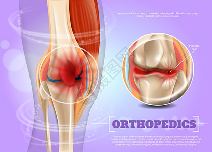 3dBannerVictor图像闭合解剖和人体膝盖结构联合图片