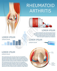 3dBannerVictorI说明人体膝盖联合疾病信息治疗药物注射以缓解疼痛图片