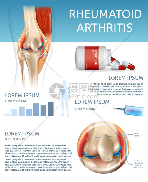 3dBannerVictorI说明人体膝盖联合疾病信息治疗药物注射以缓解疼痛图片