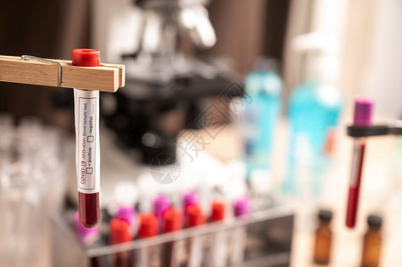 实验室新冠19实验室血液样本测试管图片