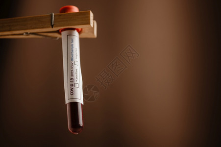 新冠19测试和化验室血样本用于诊断具有实验室背景的新科罗纳感染2019年新科罗纳疾2019年新科罗纳的血液检测图片