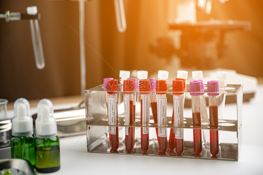 医疗实验室内的一系列人类血液样本准备进行测试