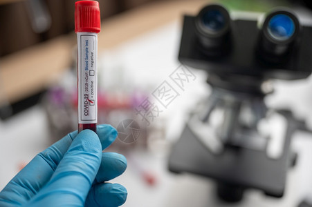 实验室技术员用血样管和板架与其他样品实验室技术员用血管样本进行化验图片
