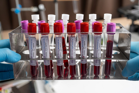医疗设备在化验室进行血液采样测试图片