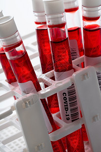 具有COVID19DNA图标的血液测试样本图片