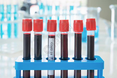 研究血液测试管的亚洲科学家在实验室或分析和研制生物19疫苗图片