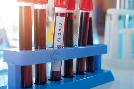 研究血液测试管的亚洲科学家在实验室或分析和研制生物19疫苗图片