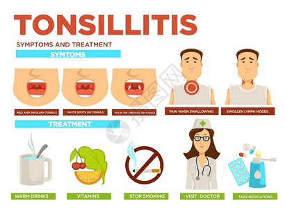 口服药丸或物维生素和热饮时喉病三联苯胺症状和治疗药品医生和病人媒在吞咽药丸或物维生素和热饮时会肿胀的顿尼略和淋巴结疼痛图片