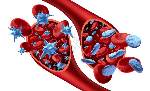 在血液和栓解剖概念中作为3D制成的动脉或血管中流的活小板热点和非活小板图片