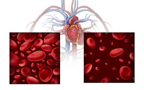 贫血和病医学图表概念是正常和异的血细胞计数动脉或血管中的人体循环是白色背景的3D插图图片