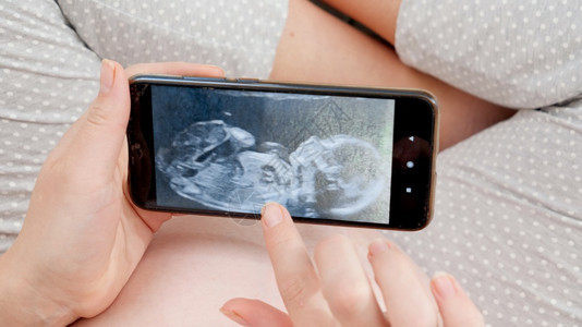 在智能手机屏幕上展示未出生婴儿的超声波图像预产期怀孕和保健概念在智能手机屏幕上展示未出生婴儿超声波图像预产期怀孕和保健概念图片