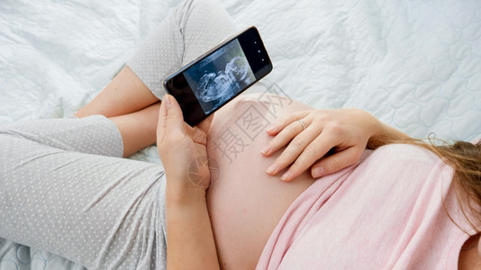 孕妇用智能手机检查超声波图像图片