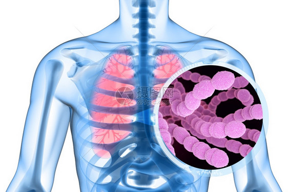 或球菌即是Gram抗体阳共振致病细菌除了之外还造成多种类型的球菌感染3D说明图片