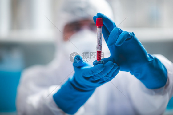 验血概念2019nCoV在医疗实验室用血管进行2019nCoV检查研究人员持有血样在医院实验室进行化图片