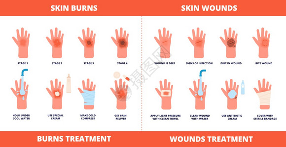 皮肤急救烧伤治疗 图片