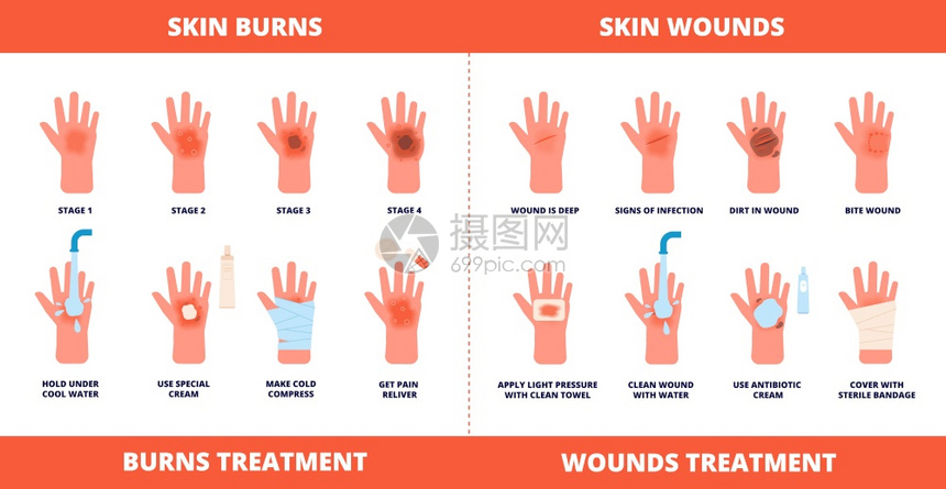 皮肤急救烧伤治疗 图片