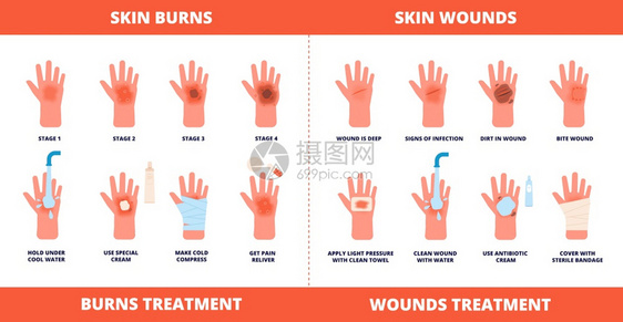 皮肤急救烧伤治疗 图片