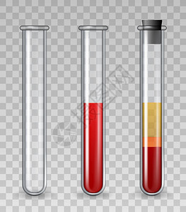 带血液的试验管现实玻璃医疗管装满红色细胞血浆丰富的小板PRP皮肤治疗矢量组说明药理学和治疗科化的试验管有血液的试验管现实玻璃医疗背景图片
