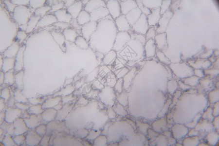 显微镜下的阿加里库斯部分图片