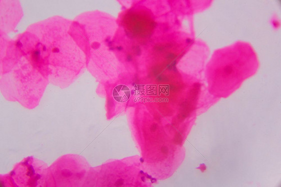 显微镜下的多孔相上白色背景上的粉红点摘要图片