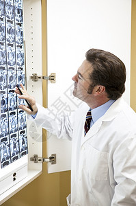 检查脊椎CT扫描的动脉科医生图片