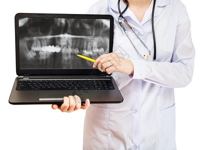 计算机膝上型电脑的护士点用X光照片拍摄白色背景隔离的屏幕上人类下巴图片