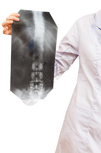 护士显示X光图片用白色背景隔离的人类脊椎柱形显示X光照片图片