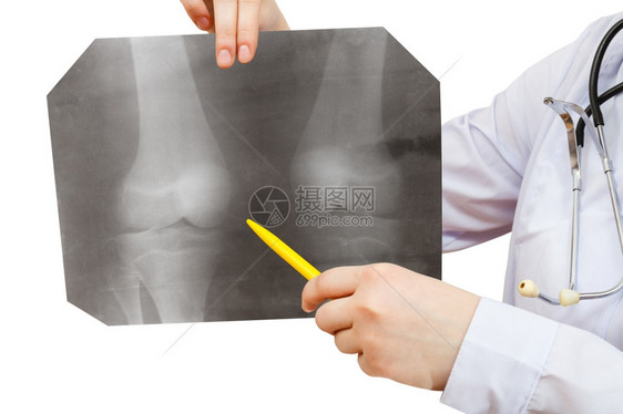 护士点X光照X片将人膝合隔离在白色背景上图片