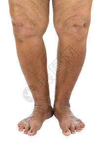 白背景与世隔绝的老年妇女腿部图片