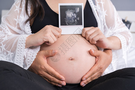 丈夫与孕妇一起进行超声波扫描图片