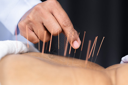 在针管治疗过程中用钢针头对老年女进行缝针检查图片