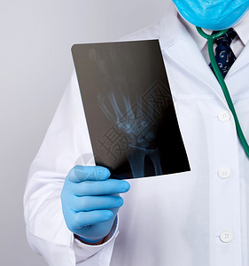 穿白色大衣和蓝乳胶手套的医生持有男子手的X光片并进行目视检查白背景图片