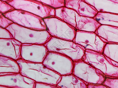 通过显微镜观察的洋葱上皮细胞光摄影洋葱上皮下细胞显微镜图片