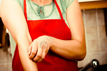女人用过敏皮疹抓痒的手臂厨房里有女压力人抓痒手臂过敏图片