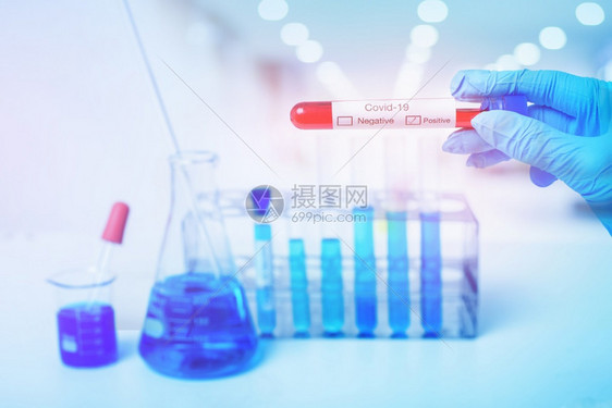 化验室助理手正在接受验血检查感染新冠图片
