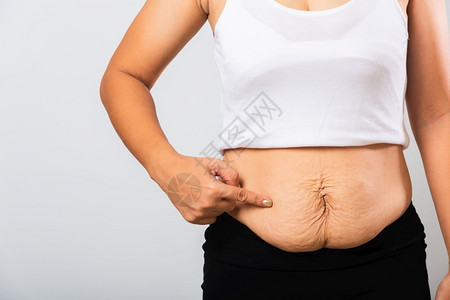 近的亚裔母亲指着伸缩标志的亚洲母亲腹部皮肤松在怀孕婴儿出生后脂肪工作室孤立在白色背景上健康腹部超重身体的概念图片