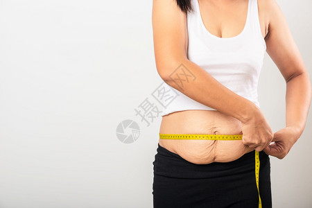 亚洲母亲在孕期分娩后白种环境中孤立的怀孕婴儿出生后脂肪的腹部皮肤松下脂肪健康腹部过量身体概念亚洲母亲使用产后部伤疤腰伸展的伤痕图片
