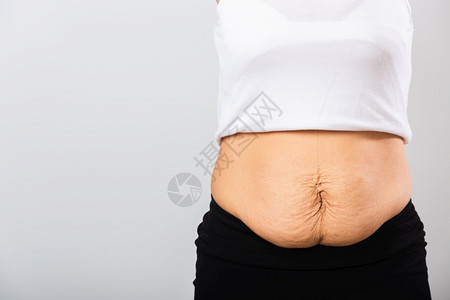 近的亚裔母亲显示伸缩腹部皮肤松她怀孕后在婴儿出生后脂肪工作室孤立在白色背景上健康腹部超重身体的概念图片