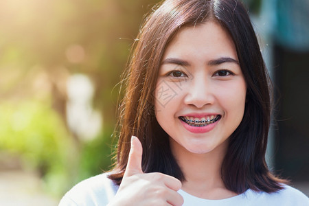 亚洲少女的肖像美丽年轻女子微笑牙齿套在上户外笑医学和牙概念图片
