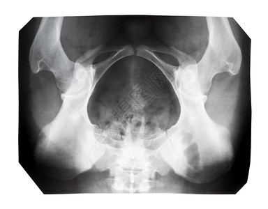 白色背景上隔离的人类女骨盆X光胶片图片