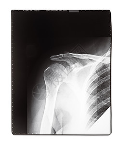 在白色背景上被隔离的人类肩膀前视面图像X光胶片图片
