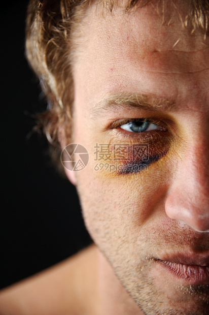 男人双眼有伤的半面脸斗争殴打图片
