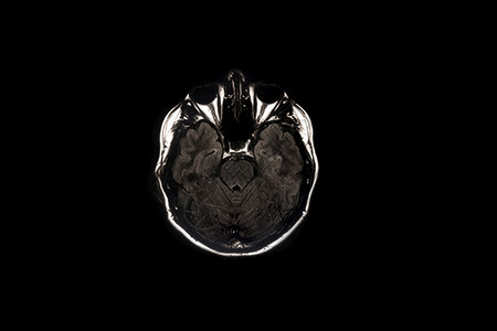 测试技术脑扫描X光成像磁的图片