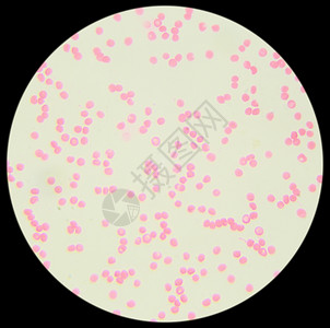 免疫学中粒细胞实验室在显微镜下的人类血液迹图片