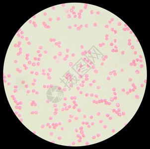 免疫学中粒细胞实验室在显微镜下的人类血液迹图片