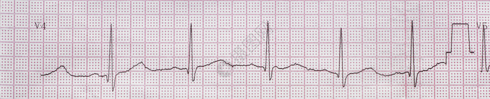 关心诊断脏电图背景生活图片