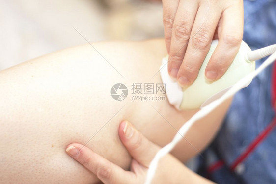 女士妇使用理发器双腿断肢移动剃须图片