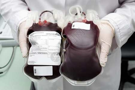 护士手中的全血滴液包括新鲜捐赠者血液药物贴纸图片