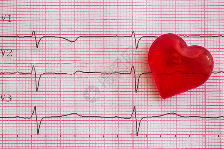 脑心电图ECG背景上的红心脏病学专家健康图片
